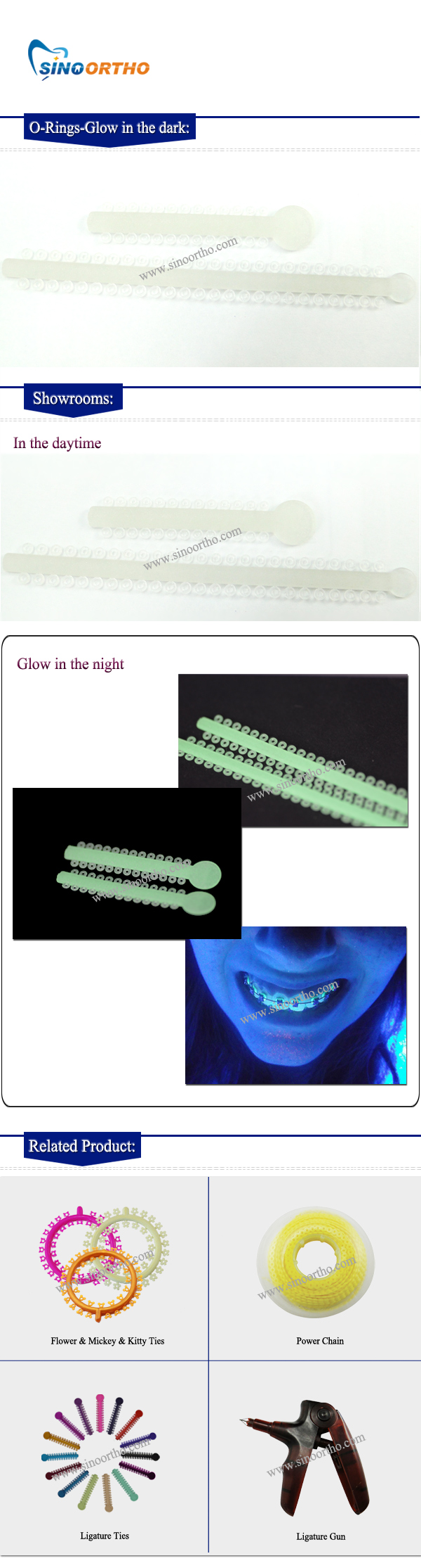 SINO ORTHO Orthodontic Orthodontic Grow in the Dark Tie Buy Product on