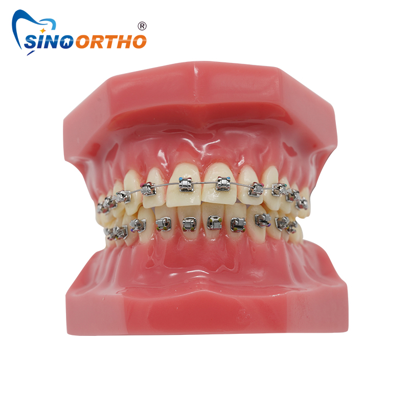 Great Wall-II SL Brackets